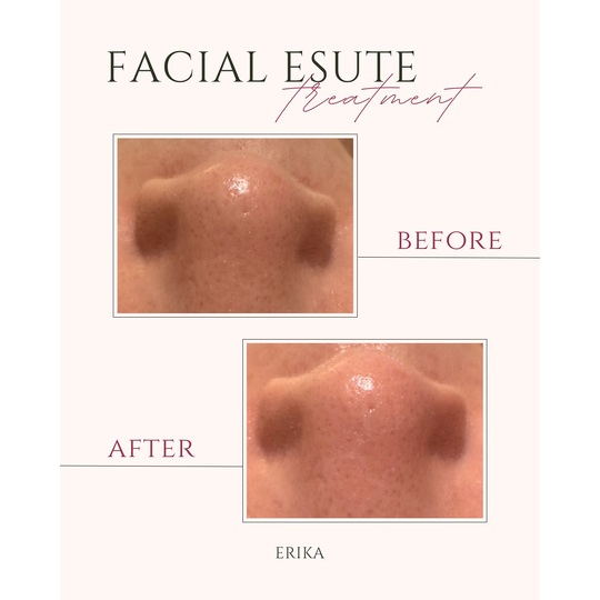 Beige and Pink Elegant Brows Treatment Before After Instagram Post
