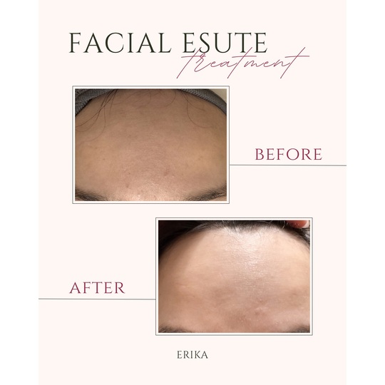 Beige and Pink Elegant Brows Treatment Before After Instagram Post 2