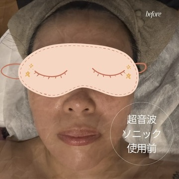 オールハンドで行うフェイシャルエステでお肌に溜まった老廃物をデトックスします